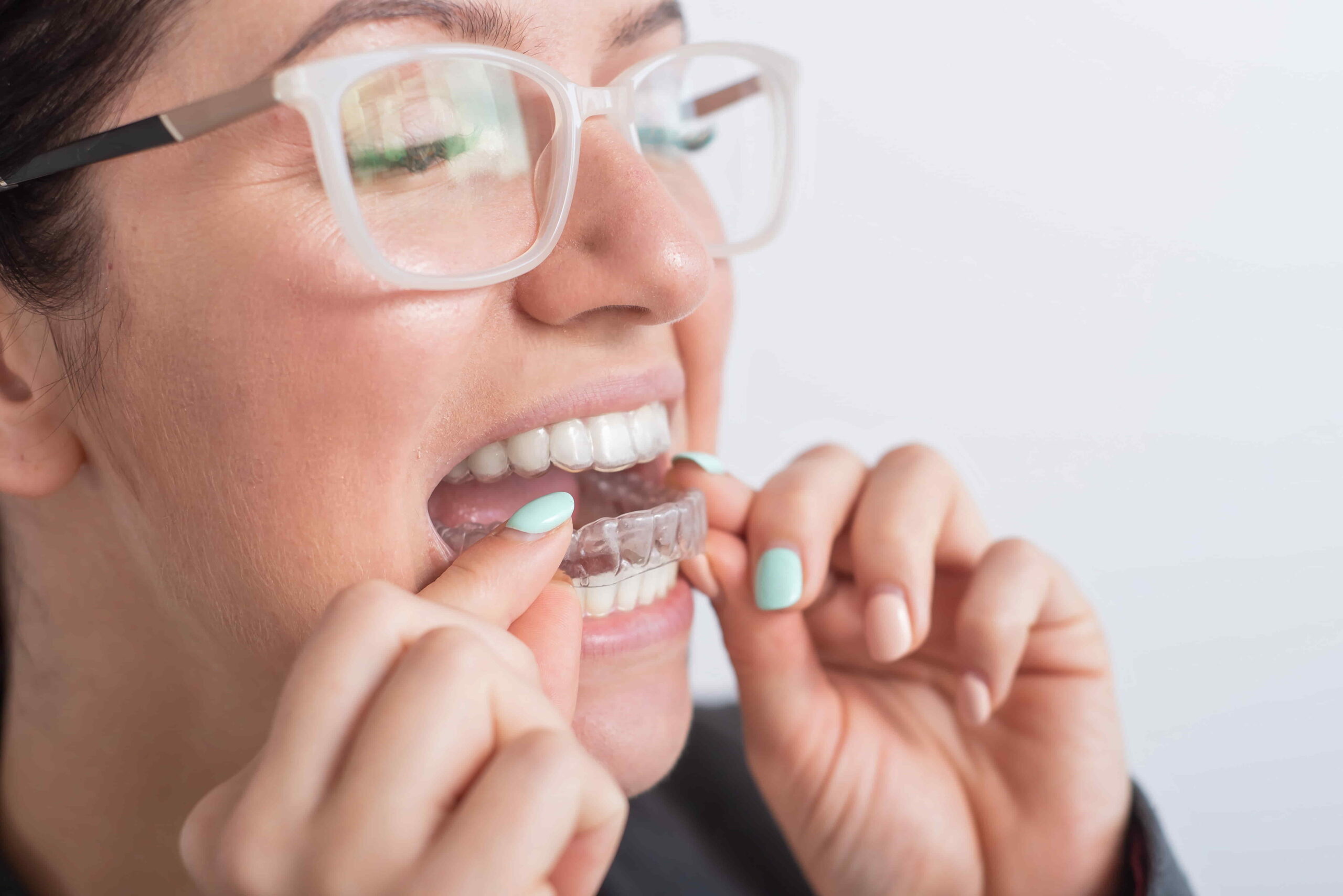 invisalign melbourne australia